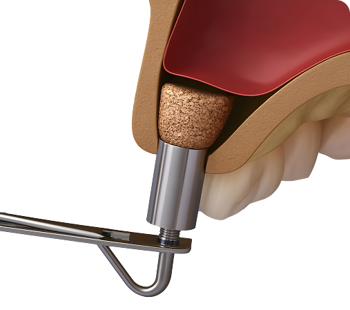 Sinus Grafts